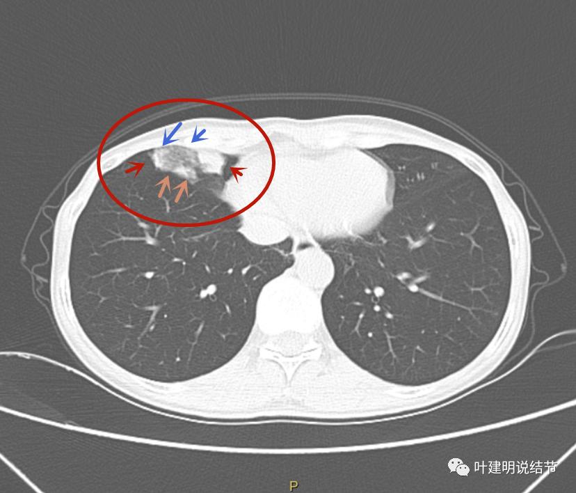 拆穿:77777888管家婆四肖八码,扼要释义、专家解读解释与落实​拒绝不实的假宣传影